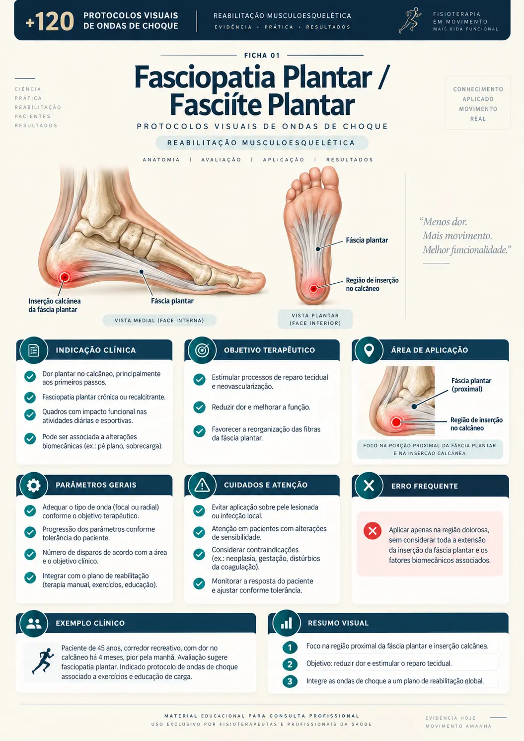 Fasciopatia Plantar / Fasciíte Plantar